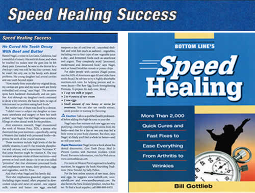 Speed Healing Success Tooth Decay